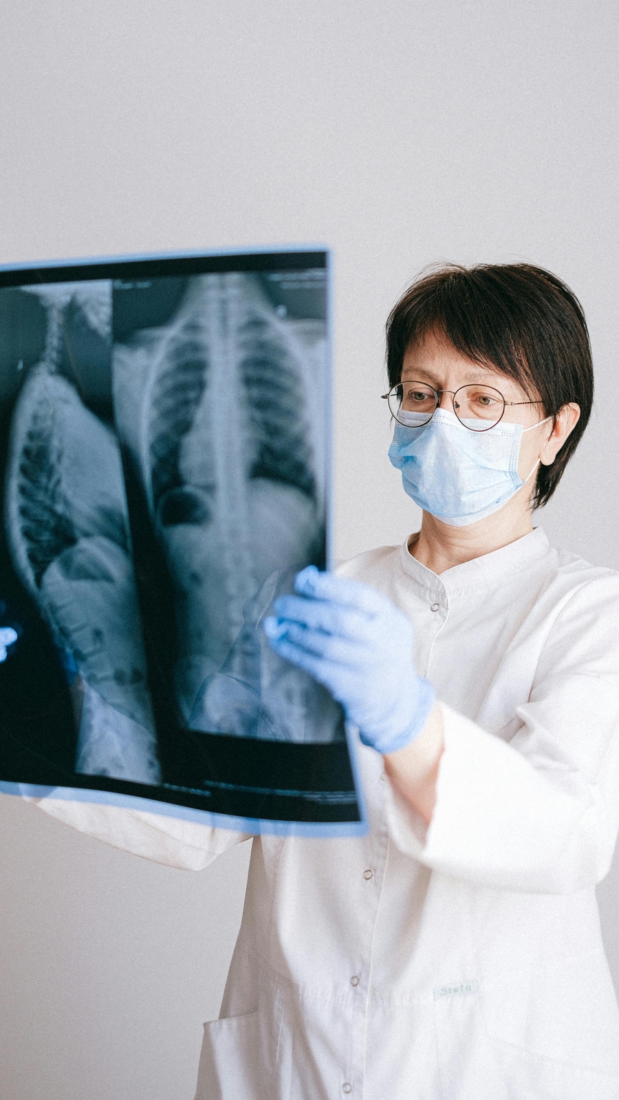 lungs_x_ray