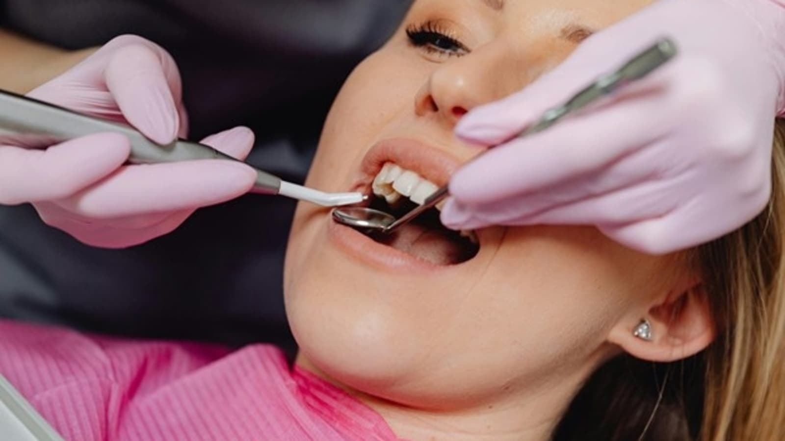 Transform Your Smile: Exploring Dental Makeovers and Celebrity Trends