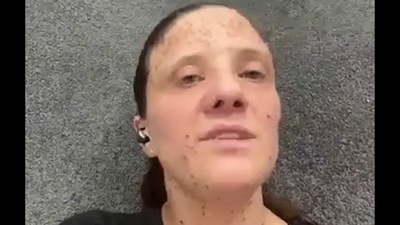 California nurse Brianna Solari kicked off Southwest Airlines flight because of her skin condition (WCNC screenshot/YouTube) California nurse Brianna Solari kicked off Southwest Airlines flight because of her skin condition (WCNC screenshot/YouTube)
