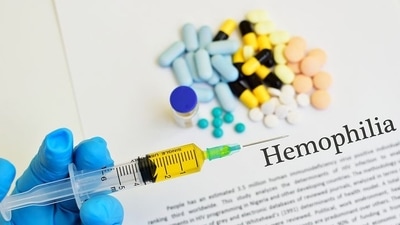 Haemophilia care: Here's how benefits and risks related to treatment of haemophilia can be balanced (Photo by RxSparkUS) Haemophilia care: Here's how benefits and risks related to treatment of haemophilia can be balanced (Photo by RxSparkUS)