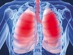 TB is a serious infectious disease that mainly affects lungs but can also affect bones, brain or other parts of the body.(Representative image) TB is a serious infectious disease that mainly affects lungs but can also affect bones, brain or other parts of the body.(Representative image)