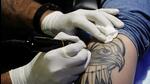 As tattoos on the body may turn out to be a hurdle for uniform services, many youth appearing for ongoing police recruitment drive are rushing to hospitals to get it removed. ((PIC FOR REPRESENTATION)) As tattoos on the body may turn out to be a hurdle for uniform services, many youth appearing for ongoing police recruitment drive are rushing to hospitals to get it removed. ((PIC FOR REPRESENTATION))