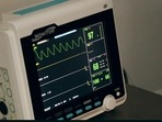 A woman in China disconnected her husband's life support (Representational image) A woman in China disconnected her husband's life support (Representational image)