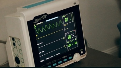 A woman in China disconnected her husband's life support (Representational image) A woman in China disconnected her husband's life support (Representational image)