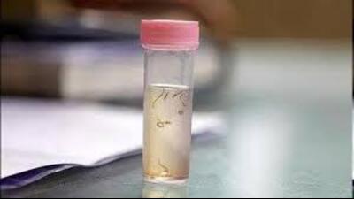 Dr Sandeep Abrol, senior medical officer at the CHC, said they first sent five samples of the water on Monday that failed tests, followed by five more that were also found to be unfit for drinking on Friday. (HT File)