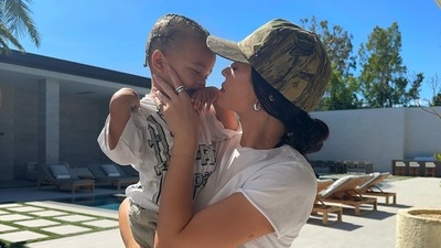 In 2018, Kylie Jenner disclosed that she "got rid" of her lip fillers. In 2018, Kylie Jenner disclosed that she "got rid" of her lip fillers. 