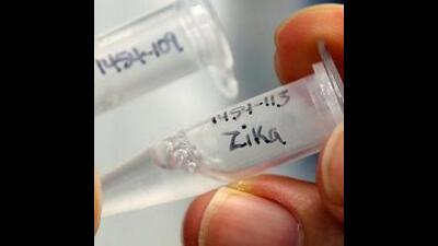 Also, four suspected Zika virus deaths have been reported in the city, one each in Baner, Kharadi, Warje and Kothrud. (REPRESENTATIVE PIC) Also, four suspected Zika virus deaths have been reported in the city, one each in Baner, Kharadi, Warje and Kothrud. (REPRESENTATIVE PIC)