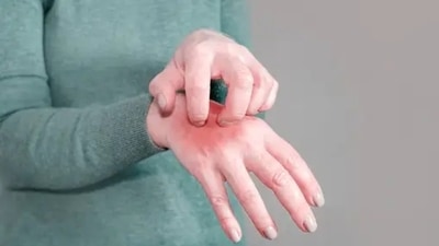 Skin diseases are running rampant in Gaza, health officials say. (Unsplash) Skin diseases are running rampant in Gaza, health officials say. (Unsplash)