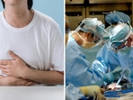 Doctors found the presence of an underdeveloped uterus and an ovary while operating on the UP man. (Pexels/cottonbro studio, Unsplash/National Cancer Institute) Doctors found the presence of an underdeveloped uterus and an ovary while operating on the UP man. (Pexels/cottonbro studio, Unsplash/National Cancer Institute)