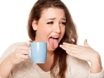 While a burnt mouth can be quite painful, it’s typically a minor injury that gets healed overtime on its own.