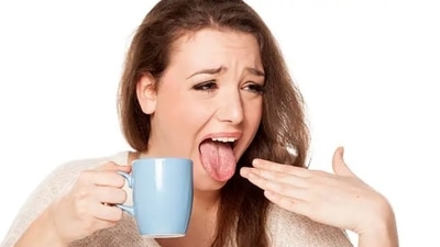While a burnt mouth can be quite painful, it’s typically a minor injury that gets healed overtime on its own. (Unsplash) While a burnt mouth can be quite painful, it’s typically a minor injury that gets healed overtime on its own. (Unsplash)