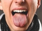 The study is based on the traditional Chinese medical practice of determining the medical conditions by examining the tongue – added Ali Al-Naji.(Unsplash) The study is based on the traditional Chinese medical practice of determining the medical conditions by examining the tongue – added Ali Al-Naji.(Unsplash)
