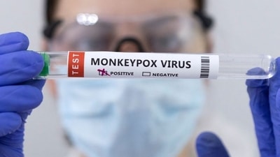 Swab samples for monkeypox being tested. (REUTERS file) Swab samples for monkeypox being tested. (REUTERS file)