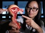A new study shows promising signs ovarian cancer can be detected in its early stages. A new study shows promising signs ovarian cancer can be detected in its early stages.