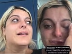 Bebe Rexha shares her distressing experience at the Munich International Airport. Bebe Rexha shares her distressing experience at the Munich International Airport.