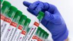 The World Health Organization (WHO) declared Monkeypox a Public Health Emergency of International Concern on August 14, the second such announcement in two years. (REUTERS) The World Health Organization (WHO) declared Monkeypox a Public Health Emergency of International Concern on August 14, the second such announcement in two years. (REUTERS)