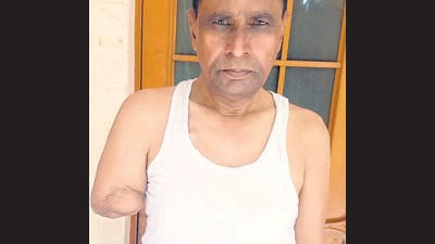 When Bijendra Singh was taken to Paras Hospital, Sector 22, Panchkula, for an upset stomach and high fever, the doctor repeatedly failed to locate a vein in his right arm and continued to insert the needle multiple times. (HT Photo) When Bijendra Singh was taken to Paras Hospital, Sector 22, Panchkula, for an upset stomach and high fever, the doctor repeatedly failed to locate a vein in his right arm and continued to insert the needle multiple times. (HT Photo)