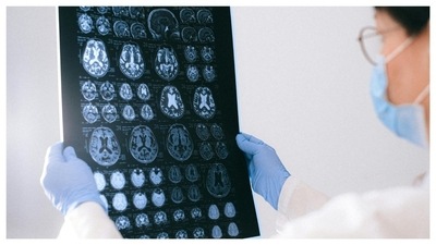 New treatment target can prevent Alzheimer’s. (Pexels) New treatment target can prevent Alzheimer’s. (Pexels)