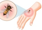 Mosquito-borne diseases like malaria, dengue, and Zika pose severe health threats, with millions affected annually and evolving drug-resistant strains complicating treatments.(Freepik) Mosquito-borne diseases like malaria, dengue, and Zika pose severe health threats, with millions affected annually and evolving drug-resistant strains complicating treatments.(Freepik)