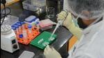 Serum Institute of India (SII) Pune on Tuesday said it is currently working to develop a vaccine for Mpox with positive outcomes expected in a year’s time. (REUTERS (PIC FOR REPRESENTATION)) Serum Institute of India (SII) Pune on Tuesday said it is currently working to develop a vaccine for Mpox with positive outcomes expected in a year’s time. (REUTERS (PIC FOR REPRESENTATION))