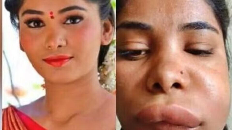 Swathi Sathish ಹಲ್ಲಿನ ಚಿಕಿತ್ಸೆಗೆ ಹೋಗಿದ್ದ ನಟಿಯ ಮುಖವೀಗ ಗುರುತೇ