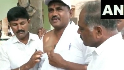 Siddaramaiah CM: ಸಿದ್ದರಾಮಯ್ಯ ಸಿಎಂ ಎಂದು ಹಚ್ಚೆ ಹಾಕಿಸಿಕೊಂಡ ಅಭಿಮಾನಿ
