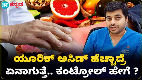 ಶರೀರದಲ್ಲಿ ಯೂರಿಕ್ ಆಸಿಡ್ ಜಾಸ್ತಿಯಾದ್ರೆ ಪರಿಣಾಮ ಏನಾಗುತ್ತೆ ಶರೀರದಲ್ಲಿ ಯೂರಿಕ್ ಆಸಿಡ್ ಜಾಸ್ತಿಯಾದ್ರೆ ಪರಿಣಾಮ ಏನಾಗುತ್ತೆ