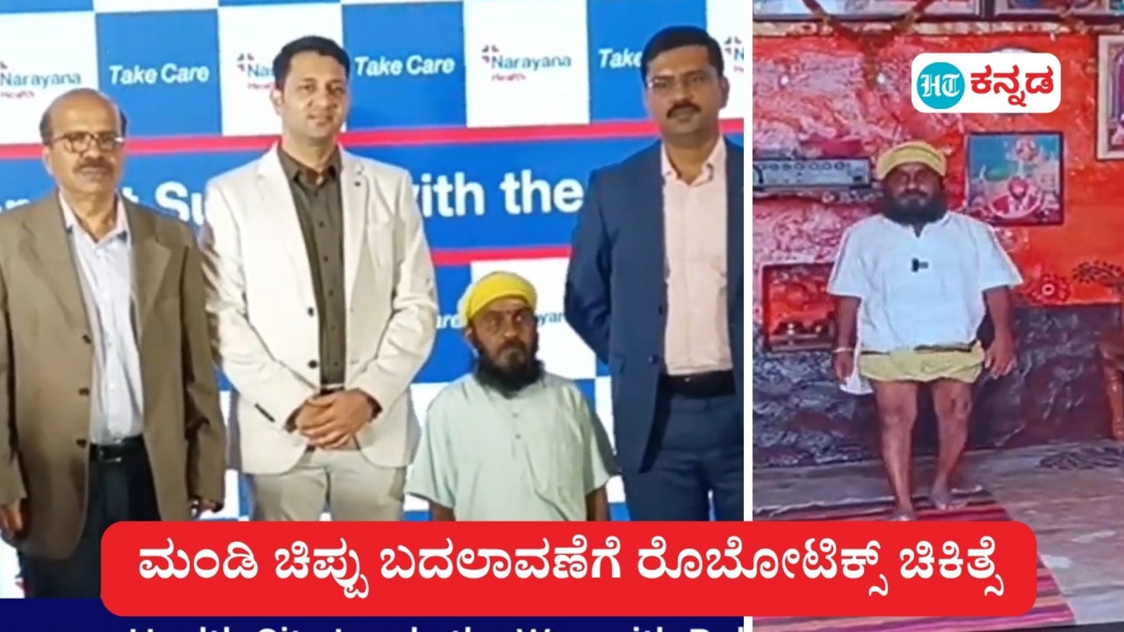 ಕಲಬುರಗಿ ವ್ಯಕ್ತಿಯ ಮಂಡಿ ಚಿಪ್ಪು ಬದಲಾವಣೆಗೆ ರೊಬೋಟಿಕ್ ಚಿಕಿತ್ಸೆ; ಬೆಂಗಳೂರು ನಾರಾಯಣ ಹೆಲ್ತ್ ವೈದ್ಯರ ತಂಡದಿಂದ ಸಂಕೀರ್ಣ ಶಸ್ತ್ರ ಚಿಕಿತ್ಸೆ