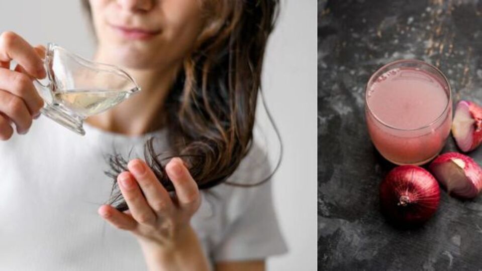 Onion Juice for Hair कांद्याचा रस केसांना लावणार आहात? आधी या गोष्टी जाणून घ्या!know these