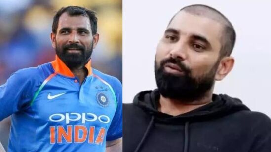 Mohammed Shami Hair Transplant