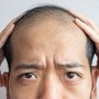<p>वयानुसार अनेकांचे केस गळायला लागतात. पण काहींचे कमी वयात केस गळती सुरु होते. या टक्कल पडलेल्या डोक्यावरचे केस परत येण्यासाठी अनेकजण विविध युक्त्यांचा आधार घेतात. काहीजण औषधही घेतात. या सर्व औषधांचे दुष्परिणाम होऊ शकतात.&nbsp;</p>