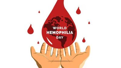 Why does hemophilia affect men more