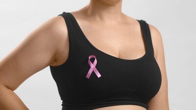 Pregnancy's associated breast cancer