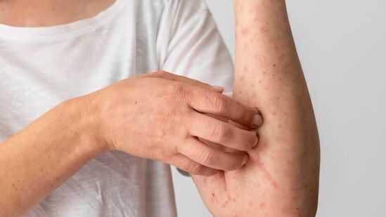 रेपेलेंट वापरा: घराबाहेर पडताना, विशेषत: डासांच्या अॅक्टिव्हिटीच्या वेळेत डीईईटी, पिकारिडिन किंवा आयआर ३५३५ सारख्या सक्रिय घटक असलेले डास प्रतिकारक किंवा रेपेलेंट लावा. रेपेलेंट वापरा: घराबाहेर पडताना, विशेषत: डासांच्या अॅक्टिव्हिटीच्या वेळेत डीईईटी, पिकारिडिन किंवा आयआर ३५३५ सारख्या सक्रिय घटक असलेले डास प्रतिकारक किंवा रेपेलेंट लावा. 