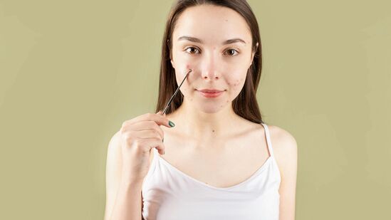 स्वच्छतेची पूर्ण काळजी घ्या, कपडे बदला आणि घाम येत असेल तर स्वच्छ कपडे घाला. आंघोळीनंतरही त्वचा कोरडी करण्यासाठी टर्किश टॉवेल किंवा सॉफ्ट टॉवेल वापरा. यामुळे त्वचा एक्सफोलिएट होणार नाही. तसेच नेहमी सैल आणि आरामदायक कपडे घाला जेणेकरून त्वचा मोकळा श्वास घेऊ शकेल. मुरुमांच्या बाबतीत कोणतीही ब्युटी प्रोडक्ट वापरू नका आणि केवळ आपल्या डॉक्टरांनी शिफारस केलेली उत्पादने वापरा. कोणतेही उत्पादन स्वत:च वापरल्यास त्वचेवर विपरीत परिणाम होऊ शकतात. मुरुमांच्या डागांपासून लवकरात लवकर मुक्त होण्याच्या प्रयत्नात कोणत्याही प्रकारचा मास्क तसेच अॅक्टिव्ह अॅसिड वापरू नका आणि या बाबतीत आपल्या डॉक्टरांचा सल्ला घ्या. स्वच्छतेची पूर्ण काळजी घ्या, कपडे बदला आणि घाम येत असेल तर स्वच्छ कपडे घाला. आंघोळीनंतरही त्वचा कोरडी करण्यासाठी टर्किश टॉवेल किंवा सॉफ्ट टॉवेल वापरा. यामुळे त्वचा एक्सफोलिएट होणार नाही. तसेच नेहमी सैल आणि आरामदायक कपडे घाला जेणेकरून त्वचा मोकळा श्वास घेऊ शकेल. मुरुमांच्या बाबतीत कोणतीही ब्युटी प्रोडक्ट वापरू नका आणि केवळ आपल्या डॉक्टरांनी शिफारस केलेली उत्पादने वापरा. कोणतेही उत्पादन स्वत:च वापरल्यास त्वचेवर विपरीत परिणाम होऊ शकतात. मुरुमांच्या डागांपासून लवकरात लवकर मुक्त होण्याच्या प्रयत्नात कोणत्याही प्रकारचा मास्क तसेच अॅक्टिव्ह अॅसिड वापरू नका आणि या बाबतीत आपल्या डॉक्टरांचा सल्ला घ्या.