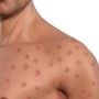 Mpox: एमपॉक्समुळे लॉकडाऊन लागणार का Mpox: एमपॉक्समुळे लॉकडाऊन लागणार का
