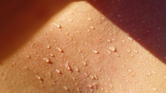 घाम येण्याची सर्व कारणे विचारात घेऊन खूप काळजी घेतली पाहिजे. "मलेरिया" नावाचा आजारही घामामुळे क्वचितच होतो. उन्हाळ्यात शरीरात घामाचे बुडबुडे वाढतात.&nbsp;