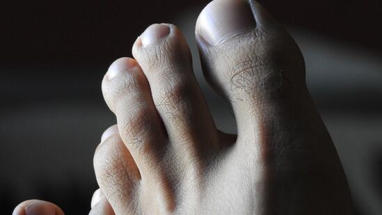 रक्तवाहिन्यांमध्ये चरबी जमा झाल्यामुळे रक्तवाहिन्या अरुंद होतात, ज्यामुळे रक्तप्रवाह कमी होतो. उच्च रक्तदाब, हायपरलिपिडेमिया आणि इन्सुलिन प्रतिकार, जे सामान्यत: मधुमेहाशी संबंधित असतात, ही समस्या वाढवतात. धूम्रपान ही देखील सवय असेल तर ही समस्या अनेक पटींनी जास्त होते.&nbsp;&nbsp;