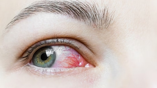 World Sight Day 2024 