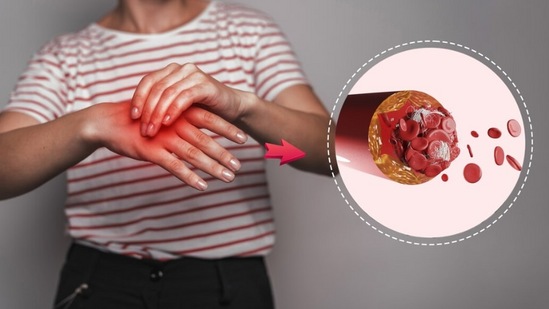 शरीरातील यूरिक ॲसिडची पातळी कमी करण्यासाठी लसणाचे सेवन खूप फायदेशीर ठरू शकते. वास्तविक, यामध्ये अँटीऑक्सिडंट्स मुबलक प्रमाणात आढळतात, जे ऑक्सिडेटिव्ह तणाव कमी करून यूरिक ऍसिड नियंत्रित करण्यास मदत करतात. याव्यतिरिक्त, दाहक-विरोधी गुणधर्म आहेत, जे सांधेदुखी आणि सूज दूर करण्यात मदत करू शकतात.