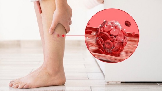 याच्या नियमित सेवनाने पचनसंस्था निरोगी राहते आणि शरीराचे डिटॉक्सिफिकेशन होण्यास मदत होते. लसणामध्ये ॲलिसिन नावाचे एक संयुग असते. जे यूरिक ऍसिड नियंत्रित करण्यास मदत करते. तसेच, संधिवात आणि &nbsp;सांधेदुखी &nbsp;होण्याचा धोका कमी करण्यास मदत करते.