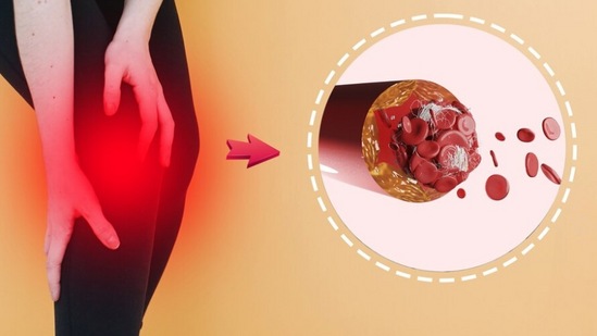 पण जेव्हा किडनी व्यवस्थित काम करत नाही, तेव्हा ते सांध्याभोवती क्रिस्टल्सच्या स्वरूपात जमा होऊ लागते. त्यामुळे सांध्यांचे दुखणे, सूज येणे, चालताना त्रास होणे अशा समस्यांना सामोरे जावे लागते. इतकेच नाही तर युरिक ऍसिडचे प्रमाण वाढल्याने गाउट, संधिवात आणि किडनी स्टोन सारख्या समस्या उद्भवू शकतात.अशा स्थितीत युरिक ॲसिडवर नियंत्रण ठेवणे खूप महत्त्वाचे ठरते.