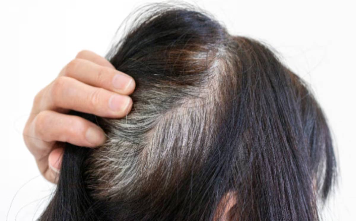 पांढऱ्या केसांची डोकेदुखी