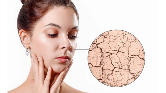 How to take care of skin in winter marathi