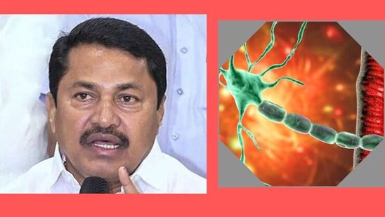 जीबीएस आजाराच्या वाढत्या प्रसार रोखण्यासाठी राज्य सरकार गंभीर नाहीः नाना पटोले