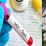 हुंड्यासाठी महिलेला HIV बाधित इंजेक्शन हुंड्यासाठी महिलेला HIV बाधित इंजेक्शन