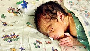 The percentage of mortality of female newborn is 17% higher than males in the state.(Pic for representation)