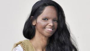 Laxmi is actively campaigning with an NGO ‘Stop Acid Attacks’.(Gurminder Singh/HT Photo) Laxmi is actively campaigning with an NGO ‘Stop Acid Attacks’.(Gurminder Singh/HT Photo)
