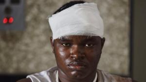 Victim of racial attack in a Greater Noida Mall, Precious Amalsima, at Kailash Hospital in Greater Noida on Tuesday.(Virendra Singh Gosain/HT PHOTO) Victim of racial attack in a Greater Noida Mall, Precious Amalsima, at Kailash Hospital in Greater Noida on Tuesday.(Virendra Singh Gosain/HT PHOTO)
