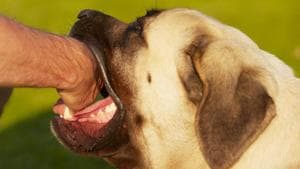 Every time a dog bites a human being, love and logic get into a dogfight.(Getty Images/iStockphoto) Every time a dog bites a human being, love and logic get into a dogfight.(Getty Images/iStockphoto)